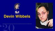 Devin Wibbels - I’m not going to change the way I look or the way I feel to conform to anything. I’ve always been a freak. So I’ve been a freak all my life and I have to live with that, you know. I’m one of those people - John Lennon